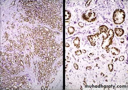Laboratory Diagnosis of Cancer
