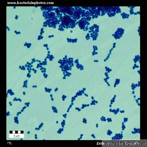 Strep. Pneumonia