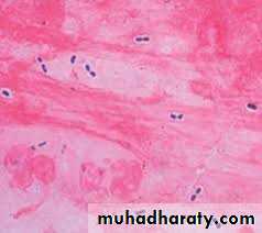 Strep. Pneumonia