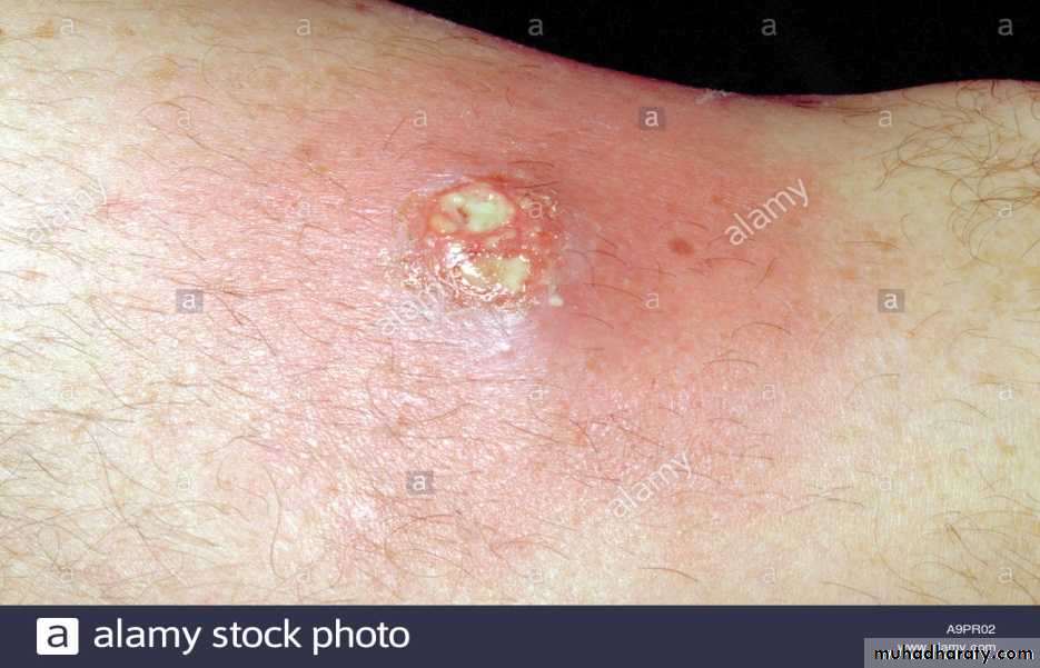 Staphylococci