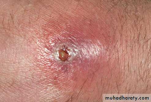 Staphylococci