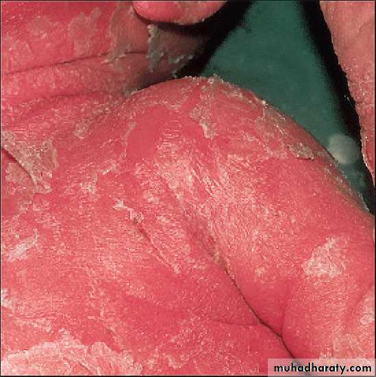 Staphylococci