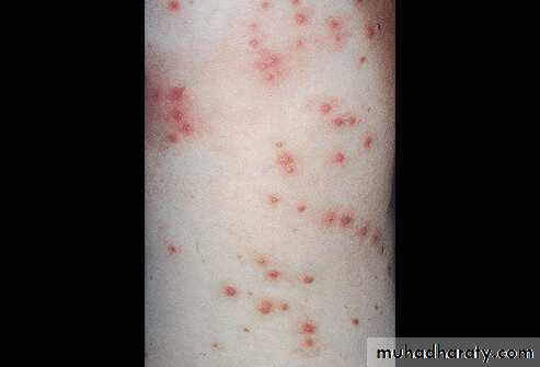 Staphylococci