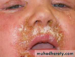 Staphylococci