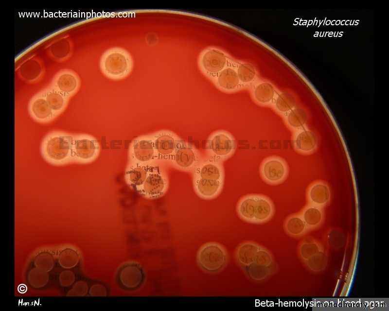 Staphylococci